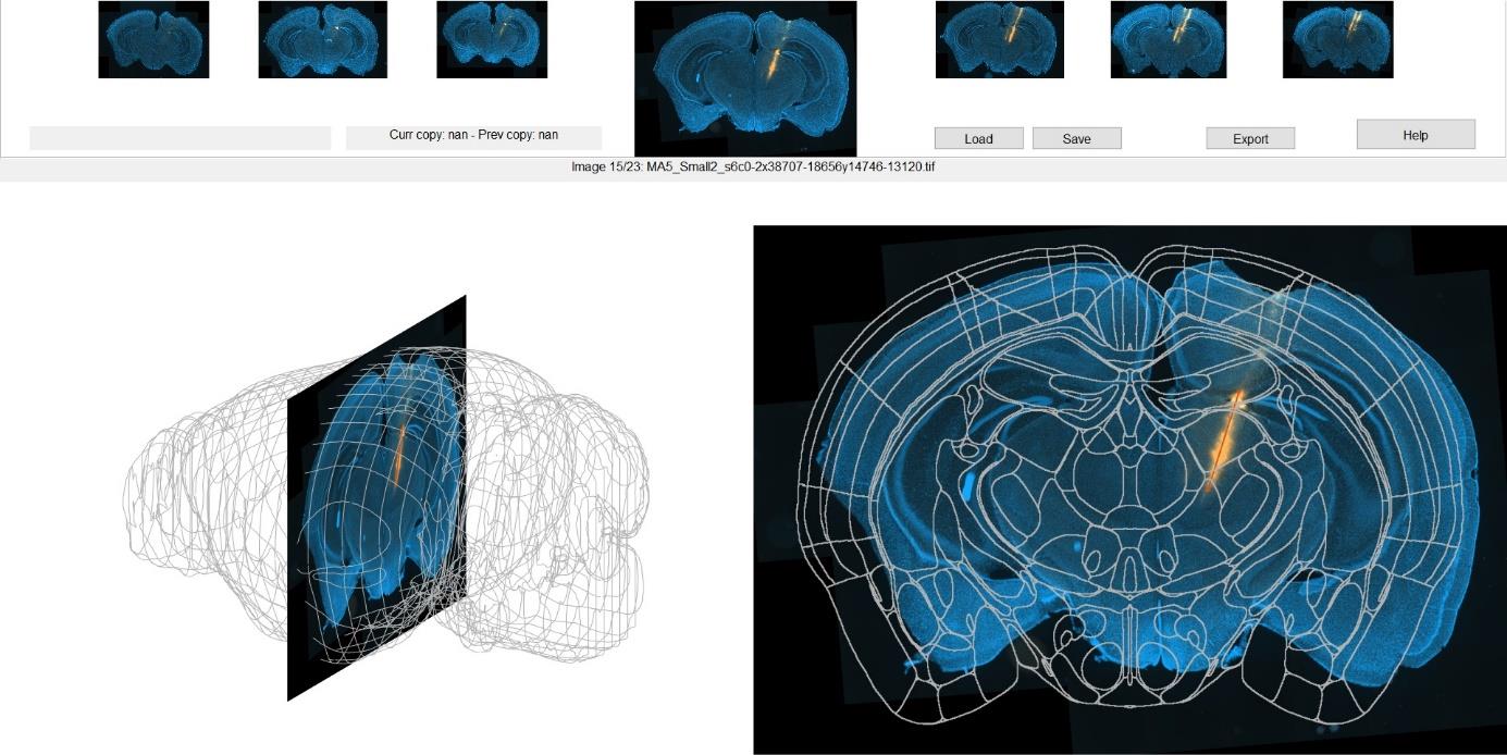 SliceFinder view